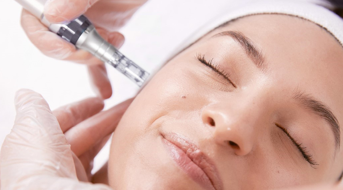 Micro Needling